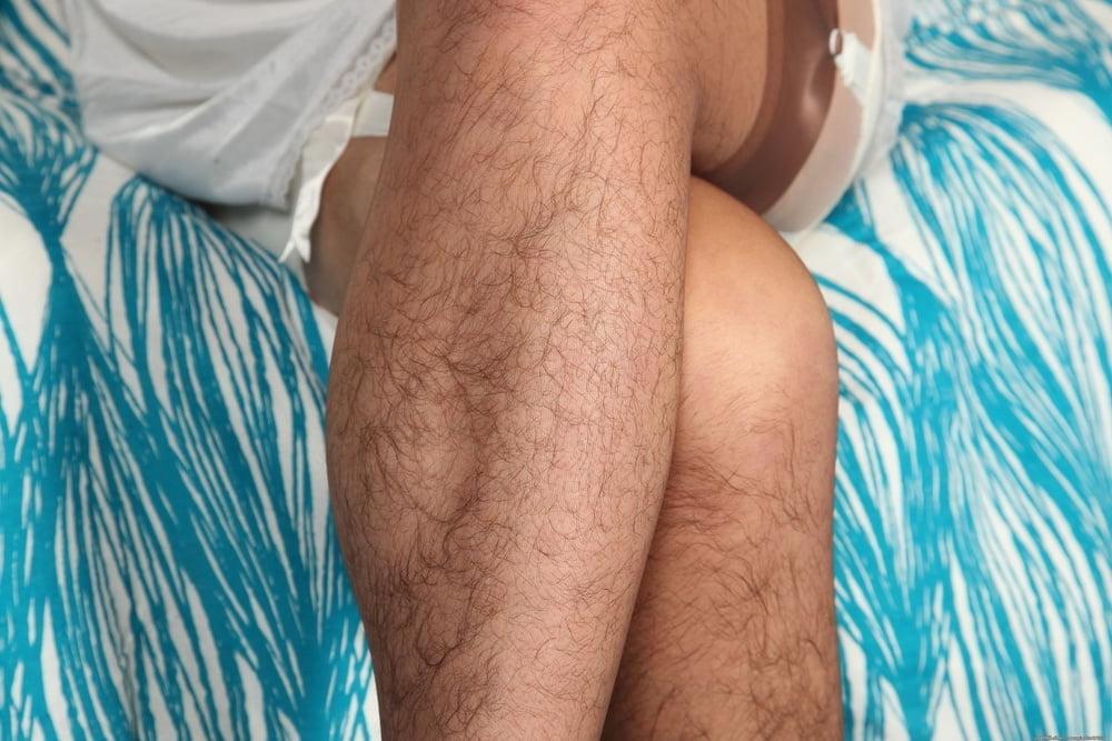 10P Hairy legs 1