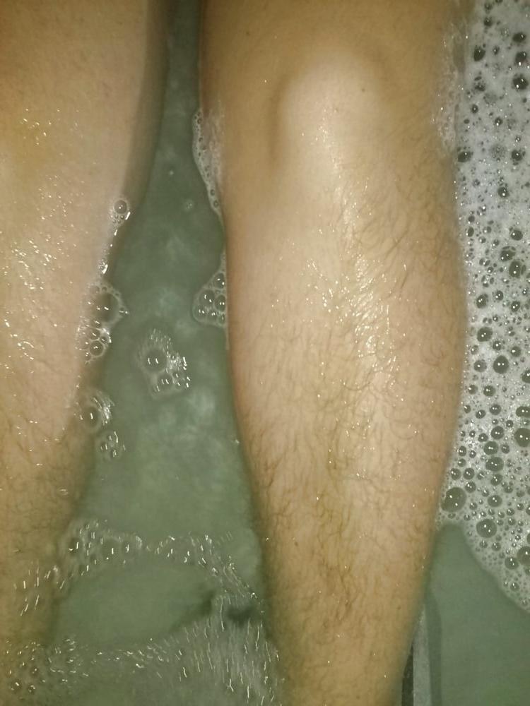 10P Hairy legs 1