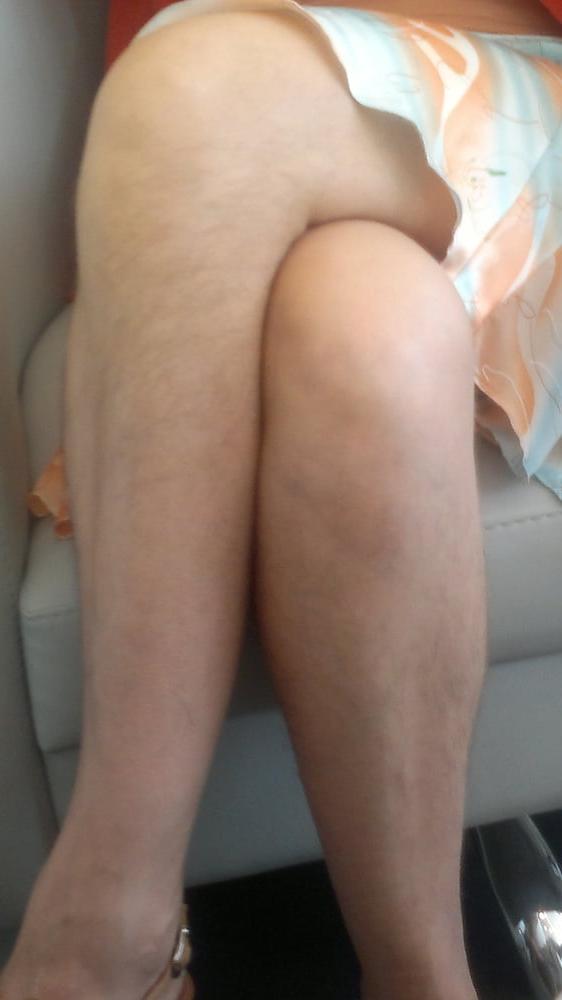 10P Hairy legs 1