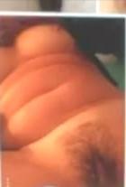 9P Hairy