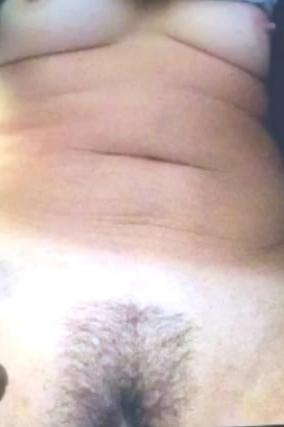9P Hairy