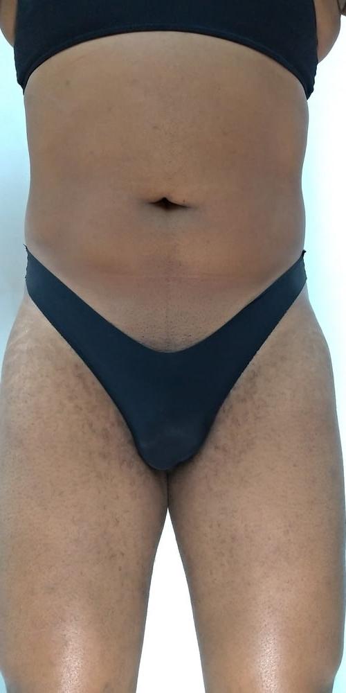 19P Panties 4