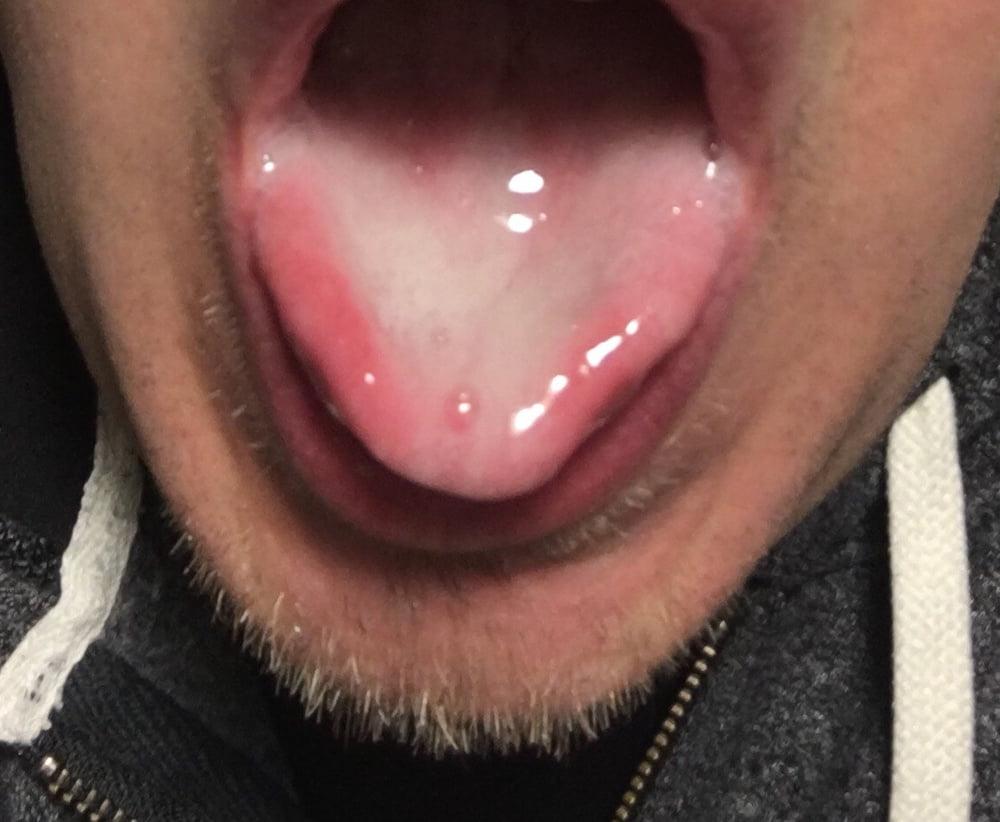 13P Cum should always be swallowed
