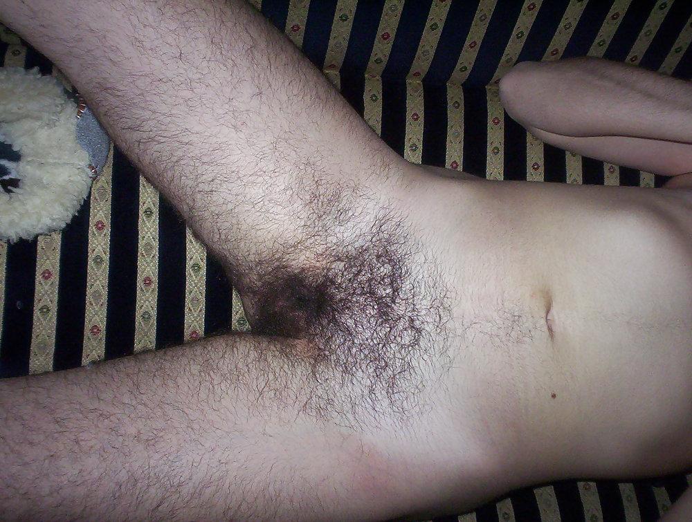 13P Extremely hairy - N. C. 