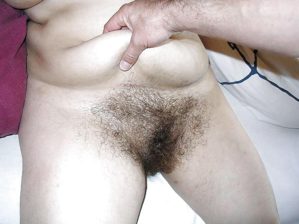 16P Hairy woman