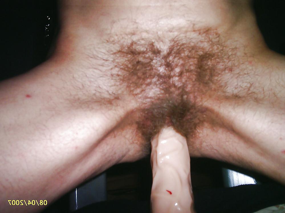16P Hairy woman