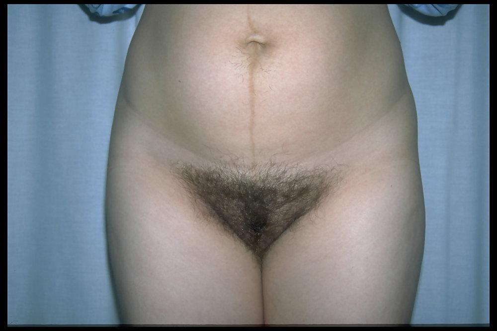 6P Full bush pregnant 5