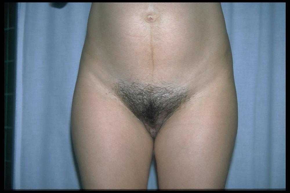 6P Full bush pregnant 5