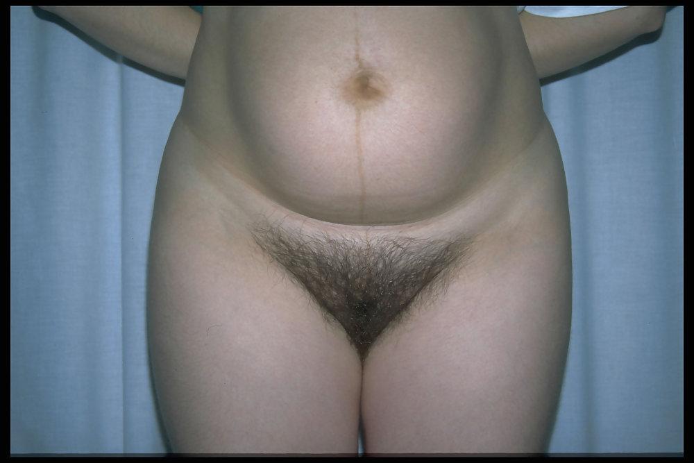 6P Full bush pregnant 5