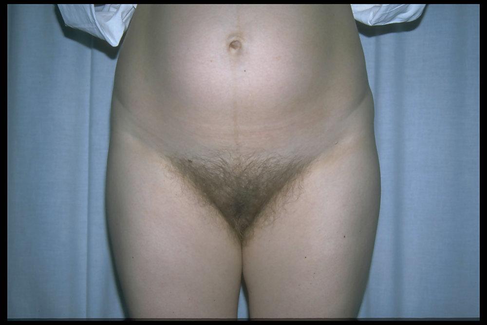 6P Full bush pregnant 5