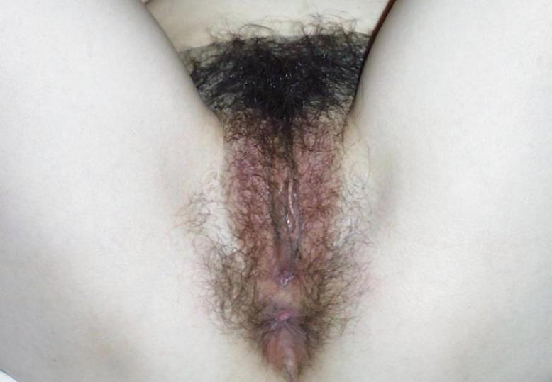 25P Hairy Amateur Pussy Late Summer Offensive 1