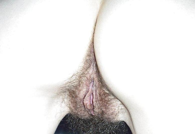 25P Hairy Amateur Pussy Late Summer Offensive 1