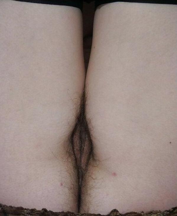 25P Hairy Mature
