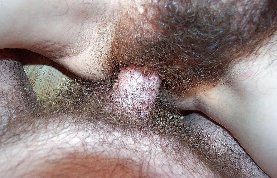 23P BEAUTIFUL HAIRY BABETTE 12