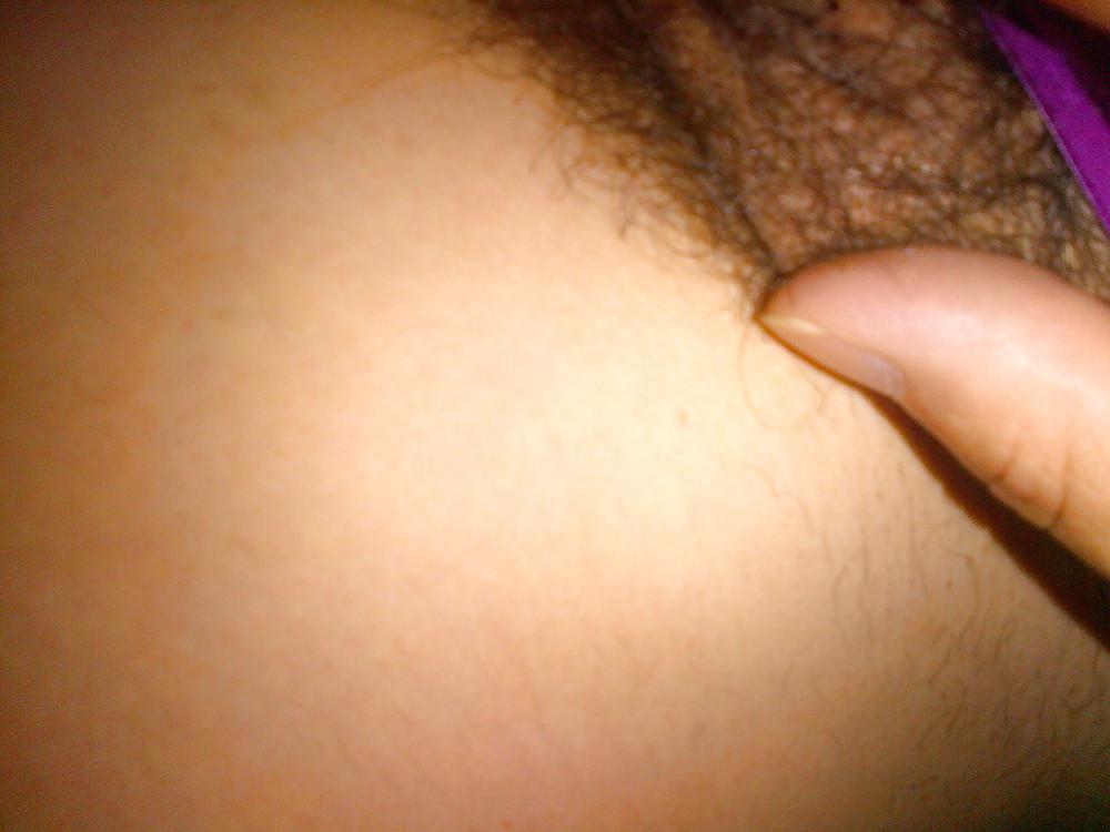8P Bush 3
