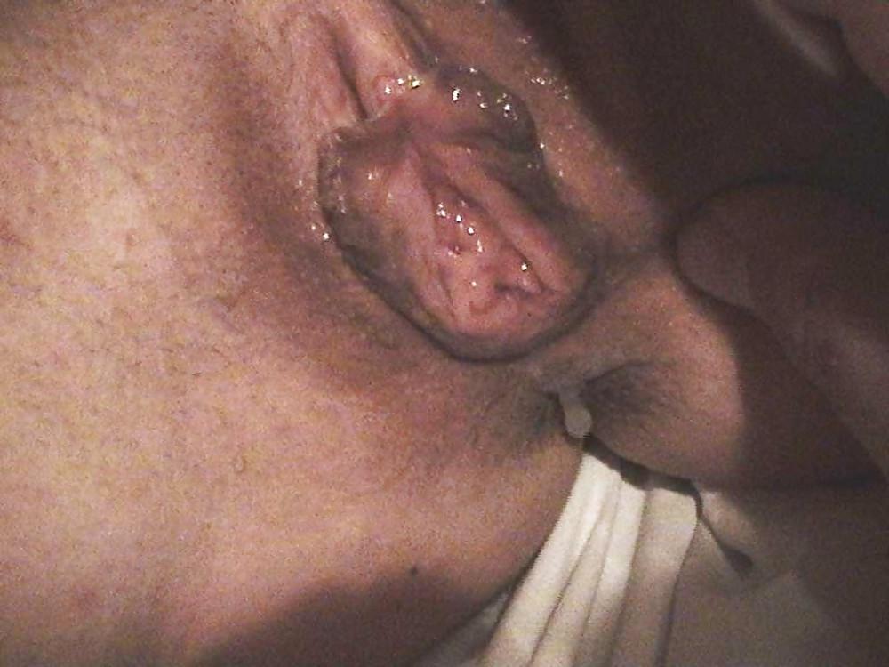 25P Wild amateur