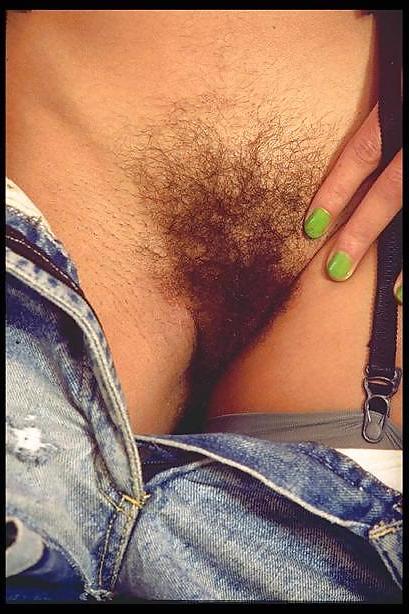 20P Hairy mix 31