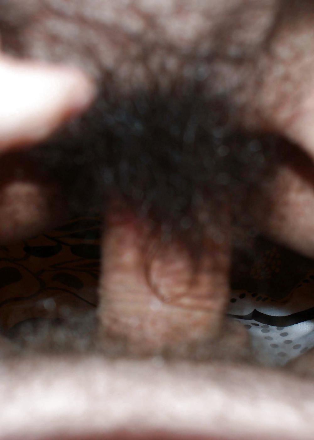 11P Ex Hairy pussy and ass