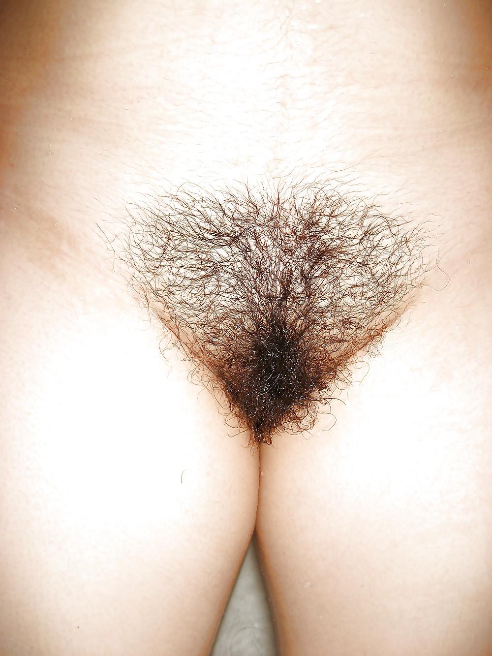 19P Hairy Bush #3