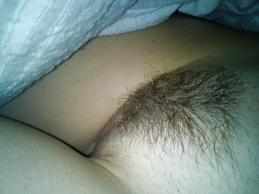 19P Hairy Bush #3