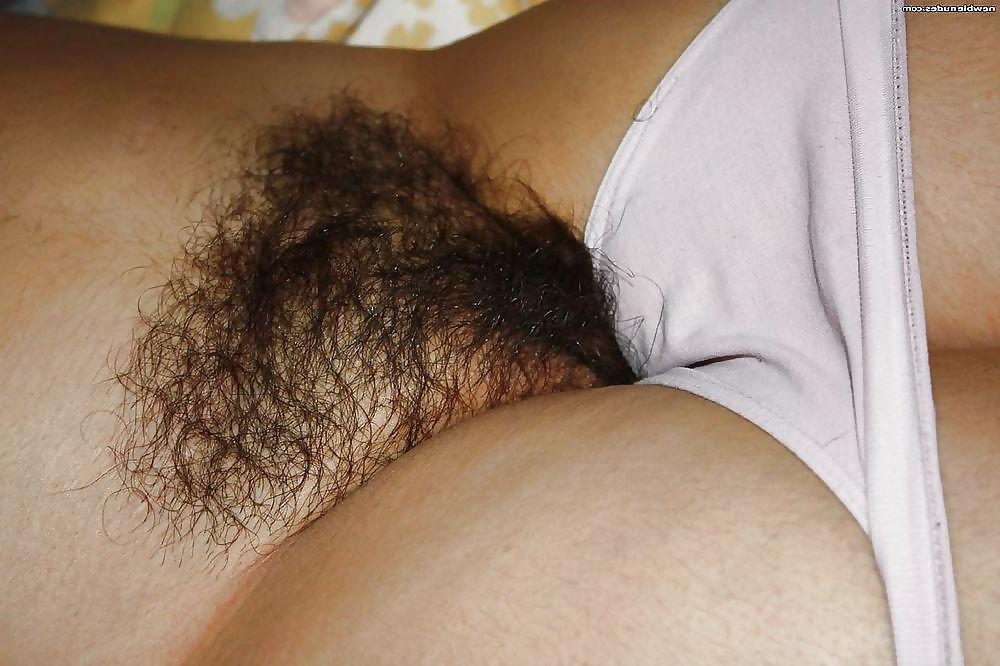 20P Hairy Bush #5