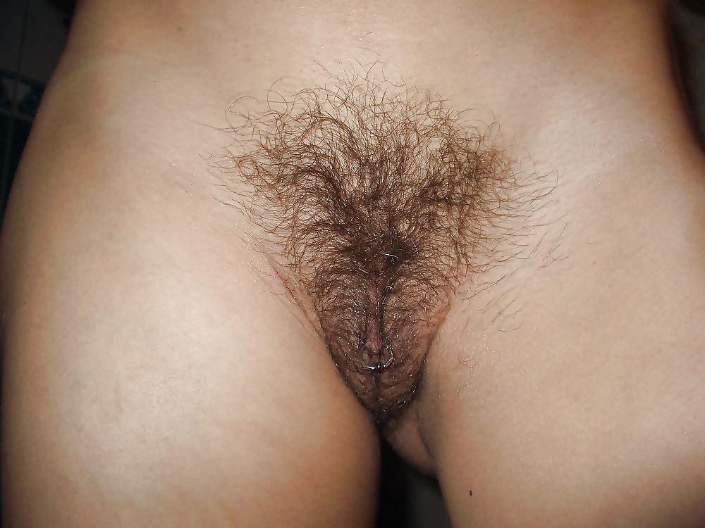 20P Hairy Bush #5