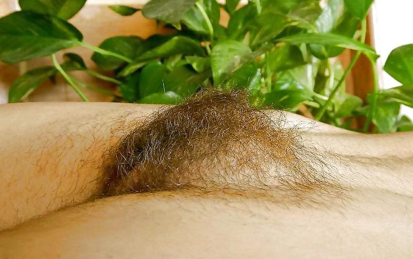 20P Hairy Bush #5
