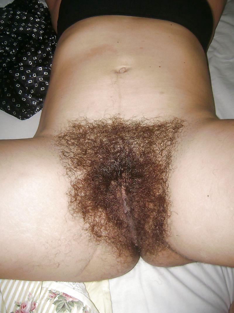 20P Hairy Bush #5