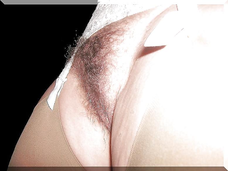20P Hairy Bush #4