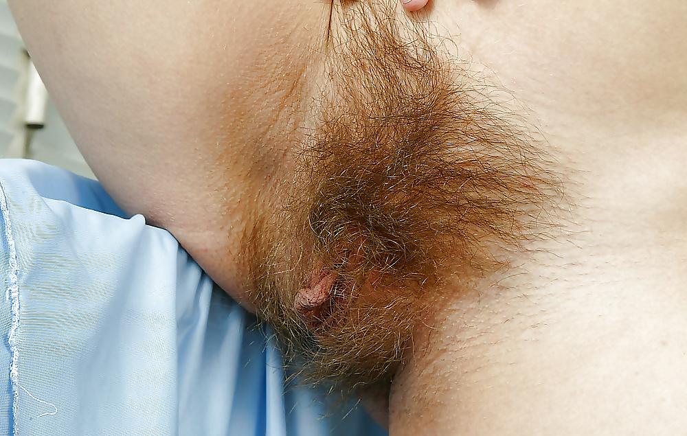 20P Hairy Bush #4