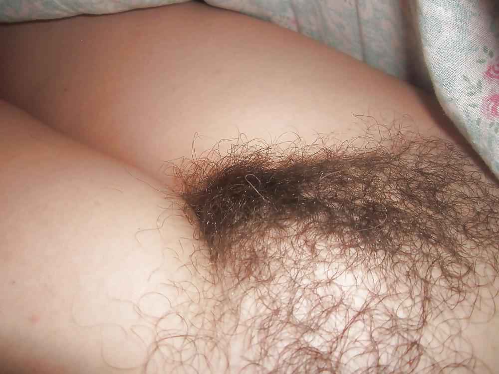 20P Hairy Bush #4
