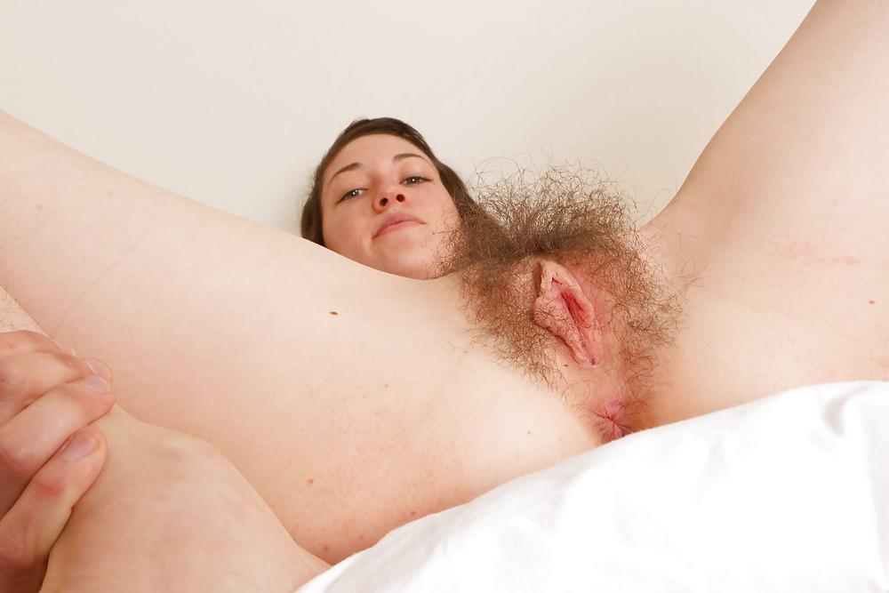 25P Hairy