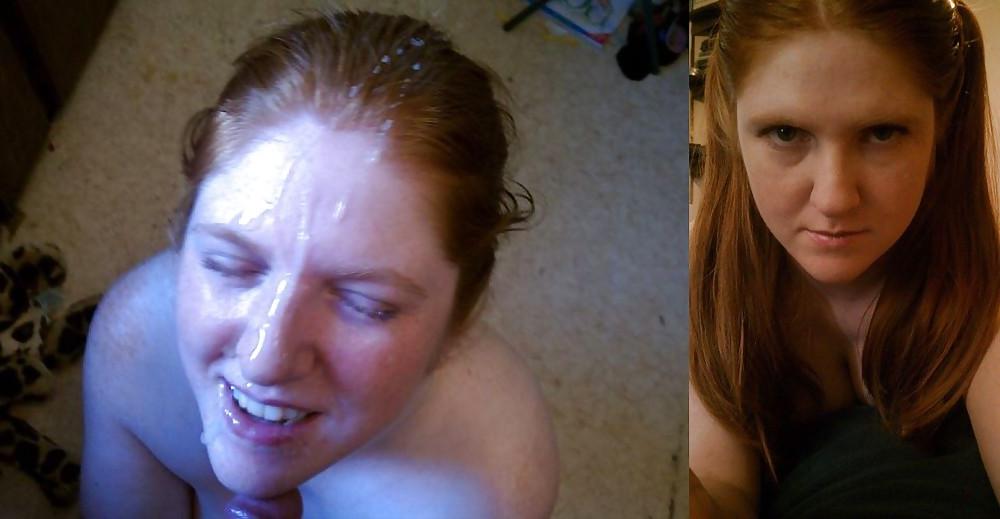 25P BEFORE & AFTER FACIALS: TEENS & MILFS