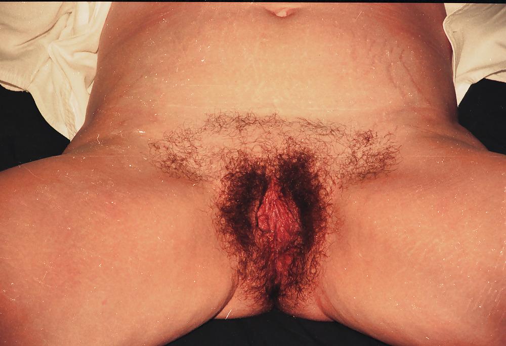 14P Big hairy bush
