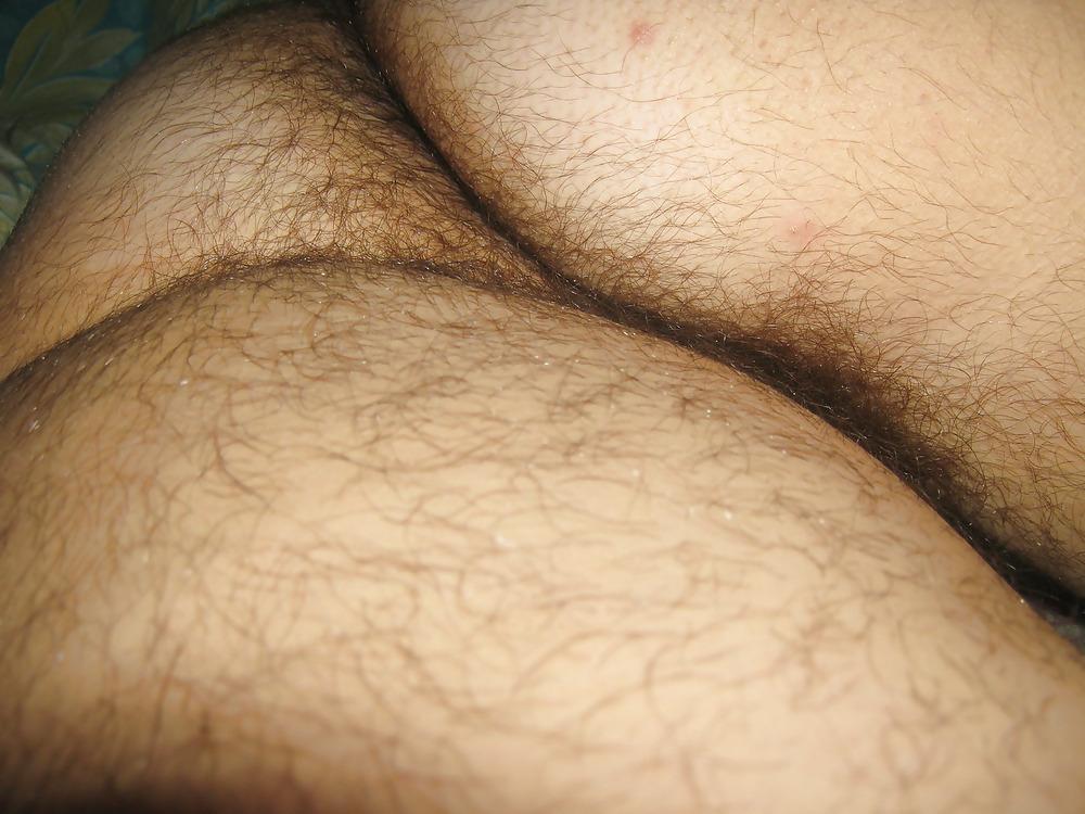 20P Some hairy ass 3
