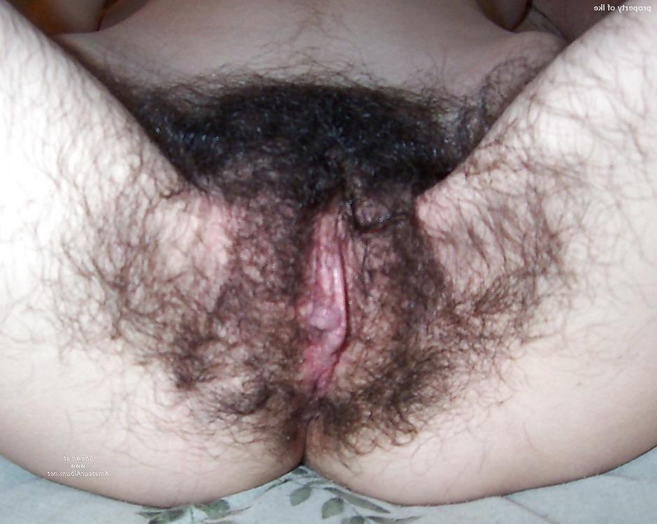 20P Some hairy ass 3
