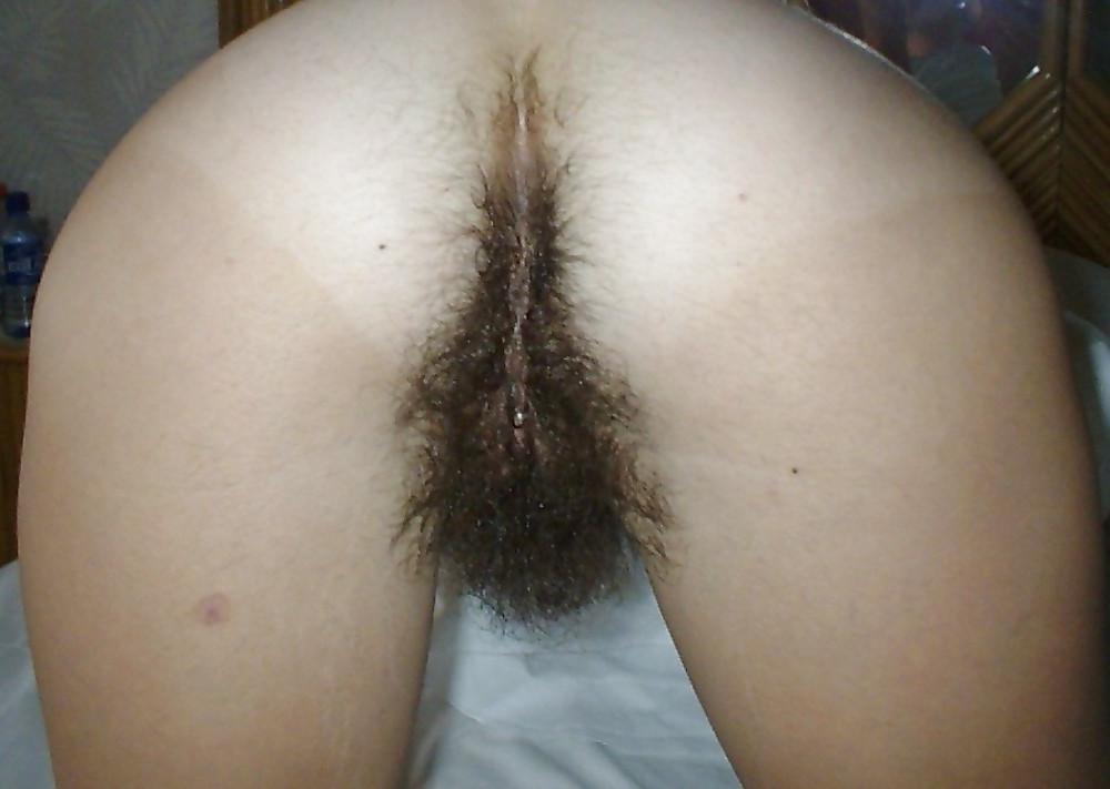 20P Some hairy ass 3