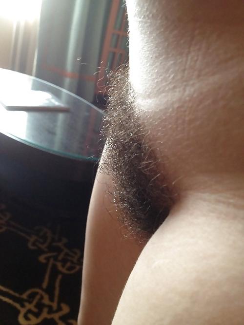 25P Hairy Gallery III