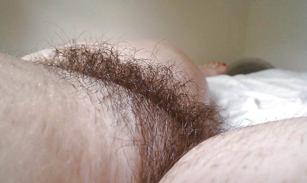 25P Hairy Gallery III