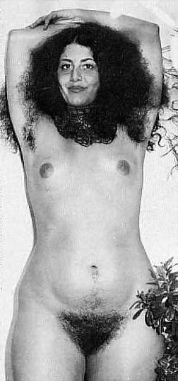 25P Hairy Gallery III