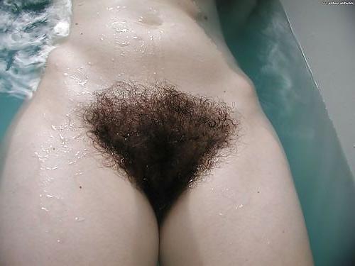 25P Hairy Gallery III