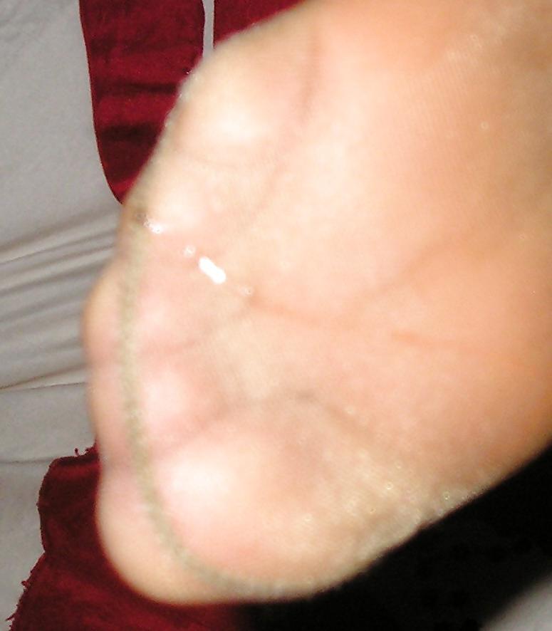 23P Zehen aus Nylon