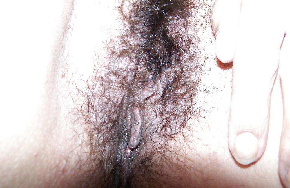 25P Hairy pussy 1