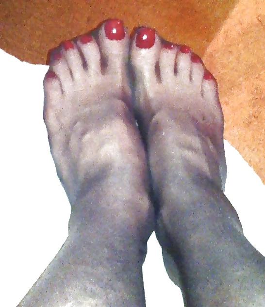 25P Nylon feet 26