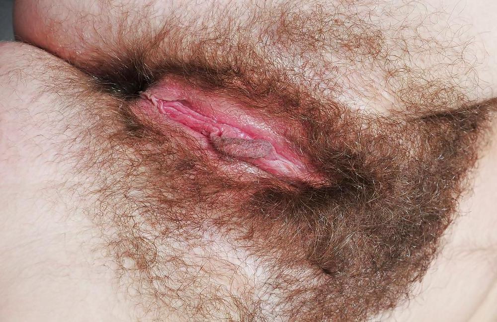 25P Hairy 8 (by tm)