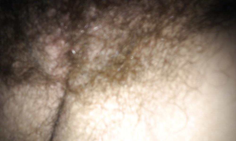 10P Hairy pussy