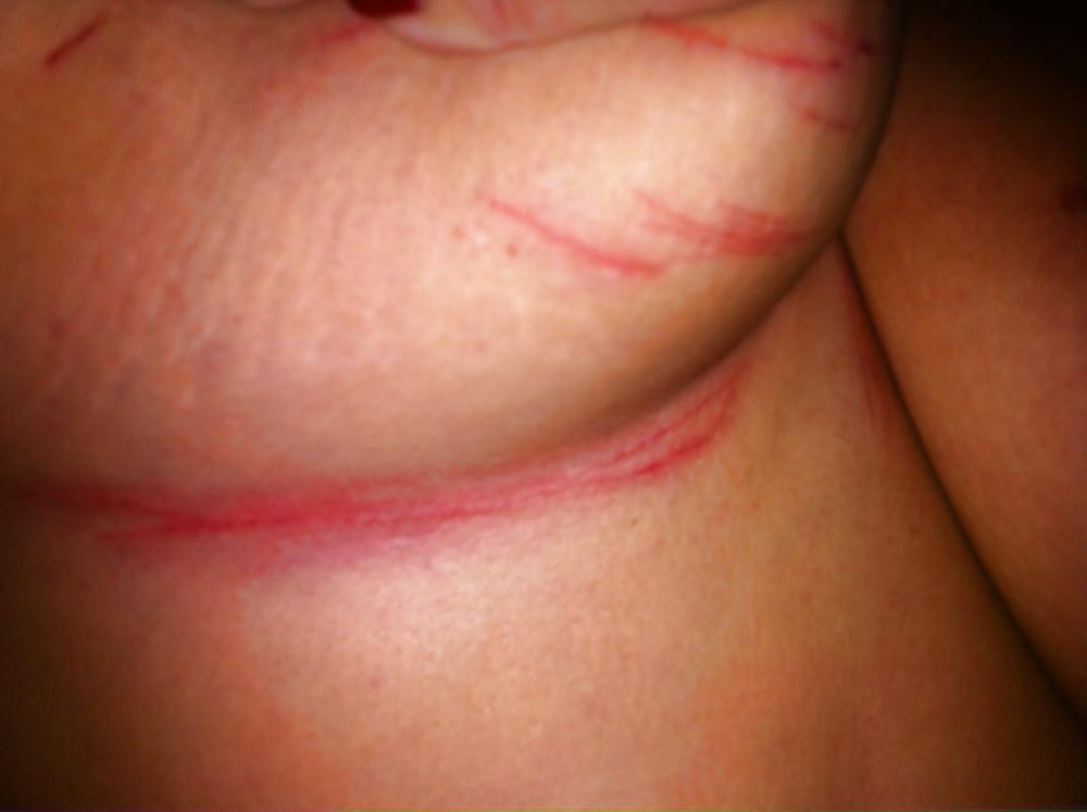 7P Scottish Slut - punished tits