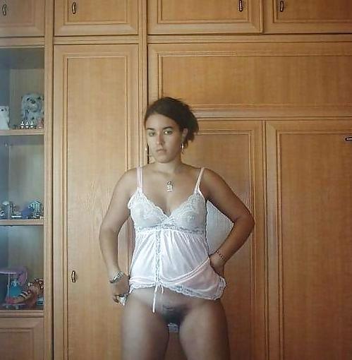 11P Hairy bottomless