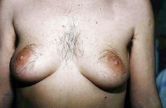 25P Hairy nipples...