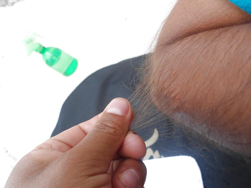 25P Girl with very hairy arms